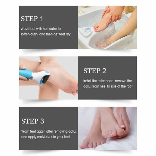 Electric Foot Grinder with Roller Rechargeable Portable Feet File Pedicure Tool Foot Scrubber Callus Remover for Dead Hard Cracked Dry Skin